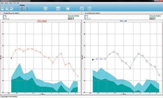 DPOAE testing screen